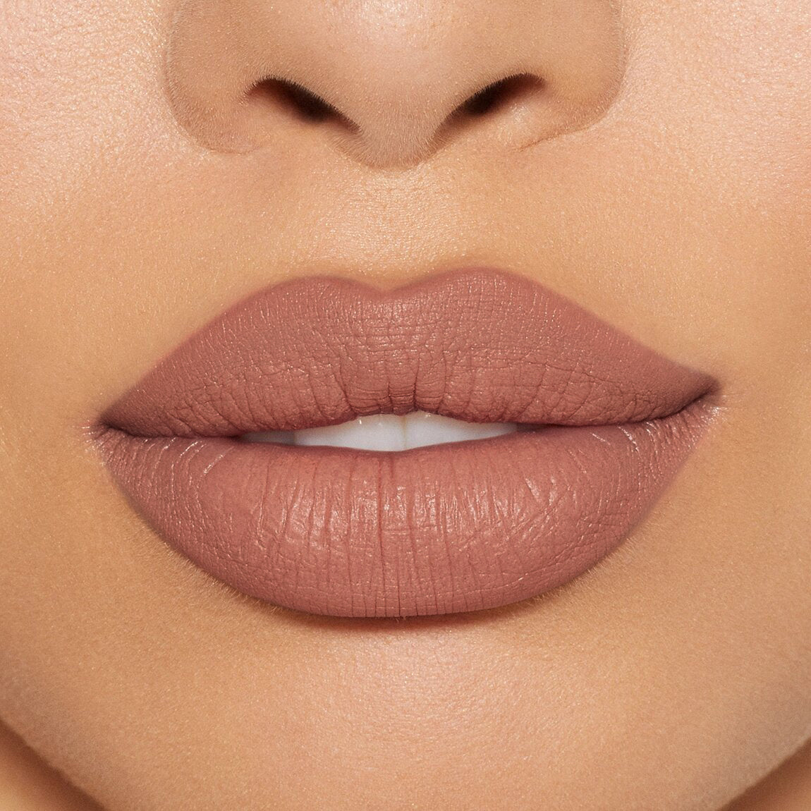LABIAL EXTRADURACIÓN