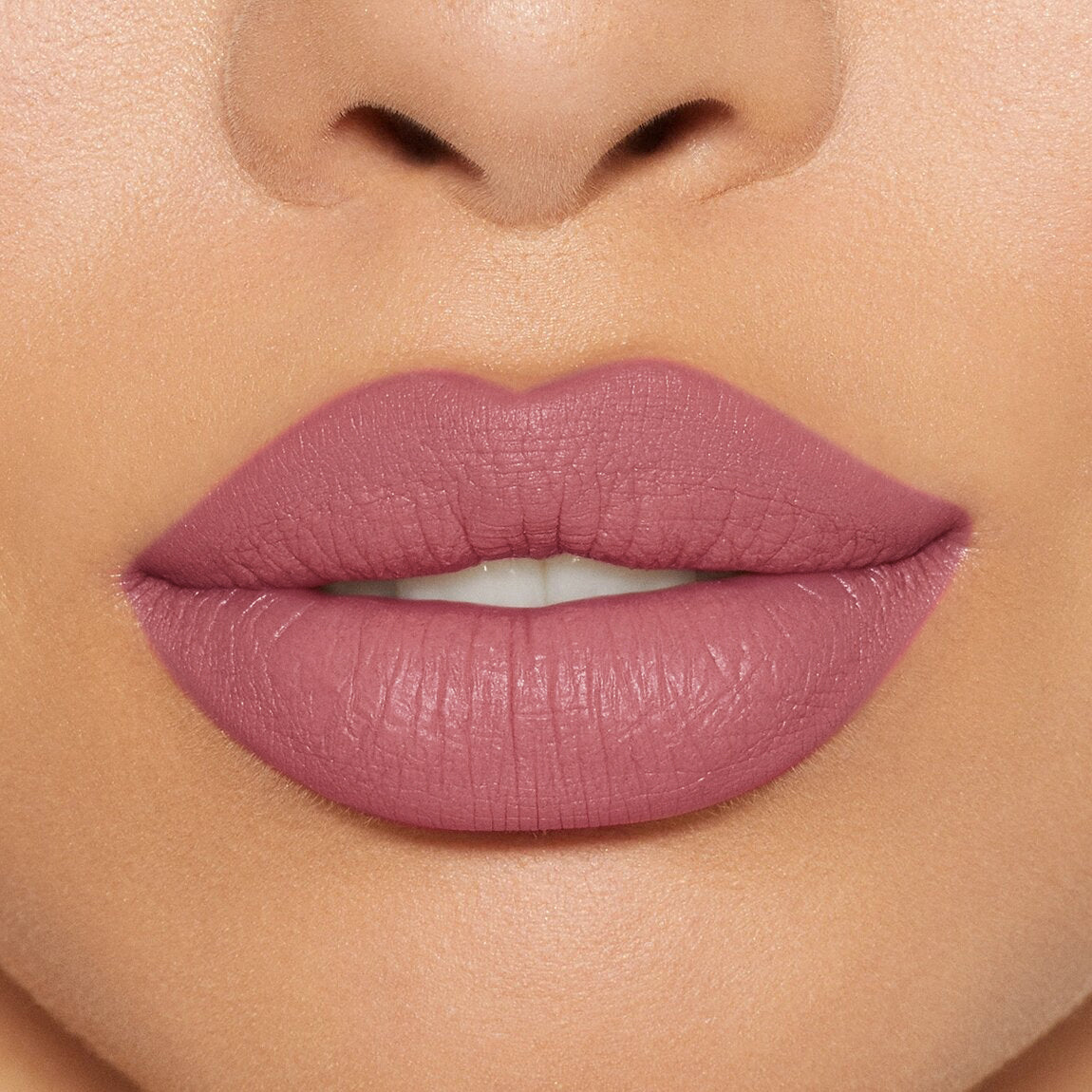LABIAL EXTRADURACIÓN