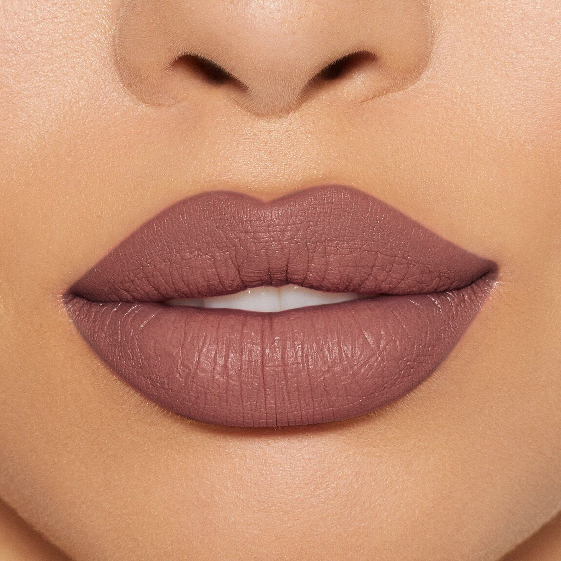 LABIAL EXTRADURACIÓN