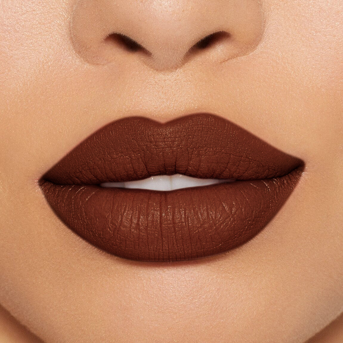 LABIAL EXTRADURACIÓN