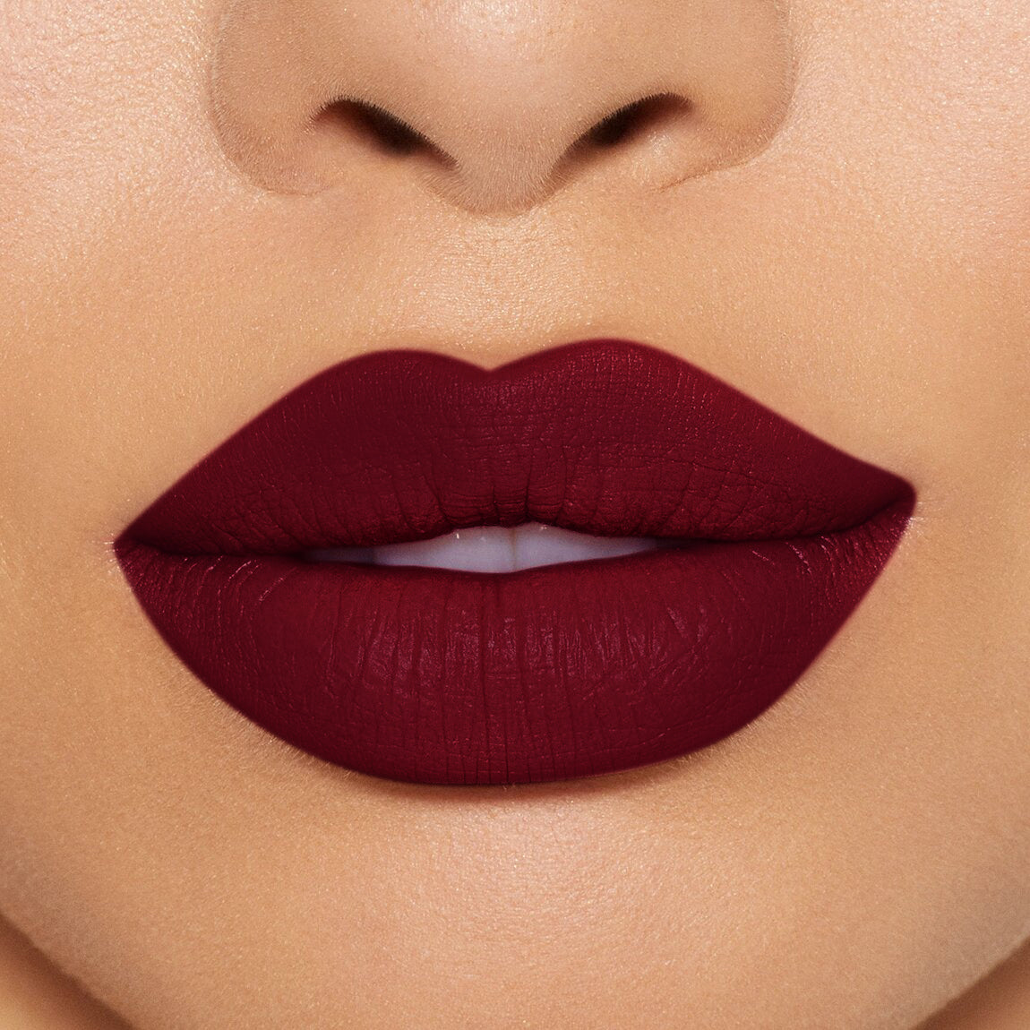 LABIAL EXTRADURACIÓN