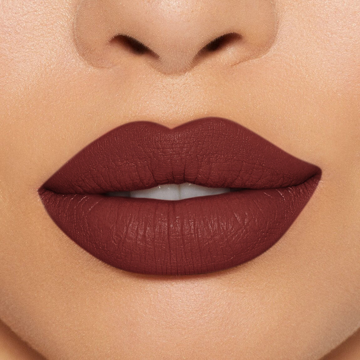 LABIAL EXTRADURACIÓN
