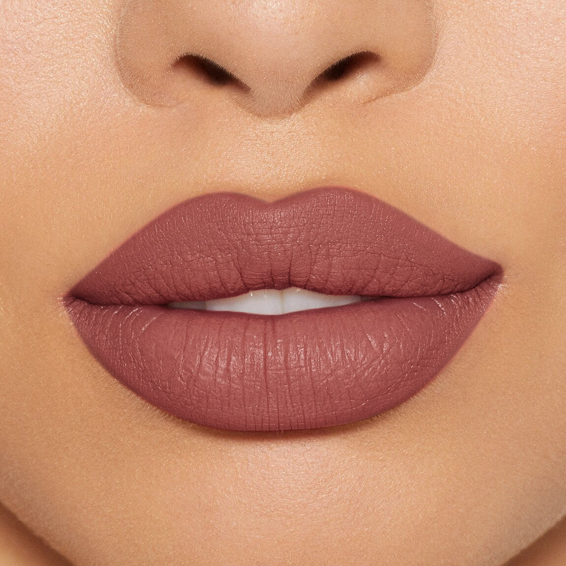 LABIAL EXTRADURACIÓN